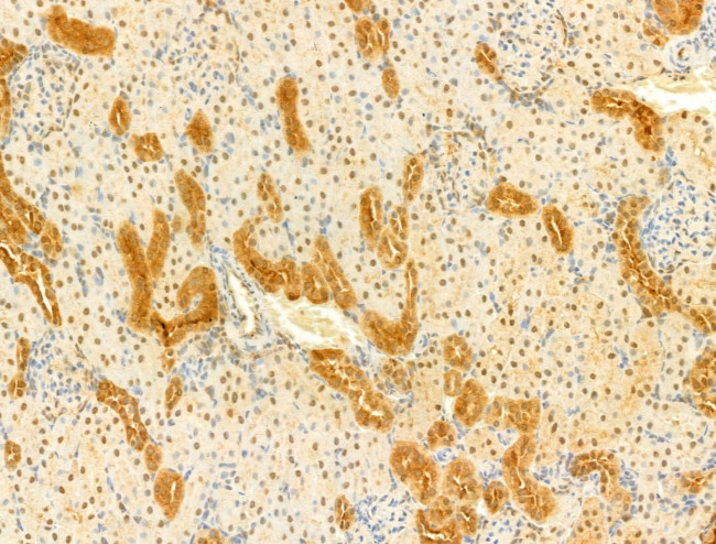 Phospho-SMAD2/SMAD3 (Thr8) Antibody in Immunohistochemistry (Paraffin) (IHC (P))