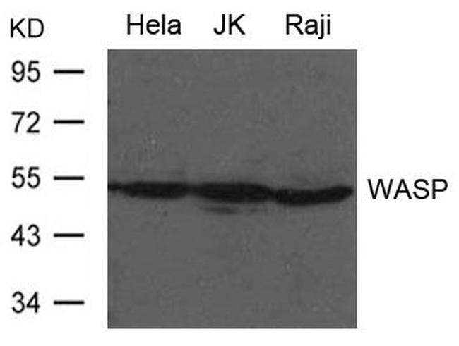 WASP Antibody in Western Blot (WB)