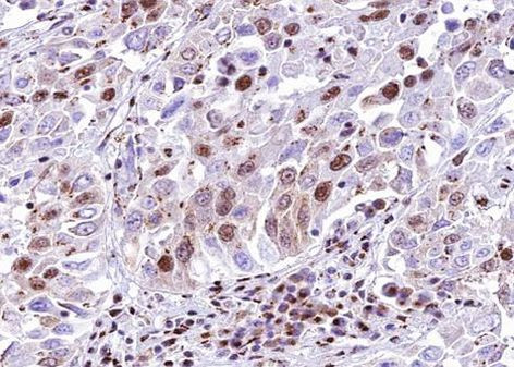 SMAD6 Antibody in Immunohistochemistry (Paraffin) (IHC (P))