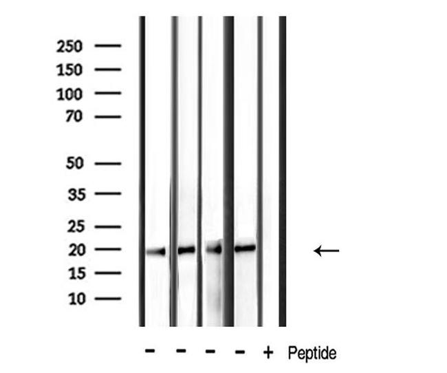 PDGF-A Antibody in Western Blot (WB)