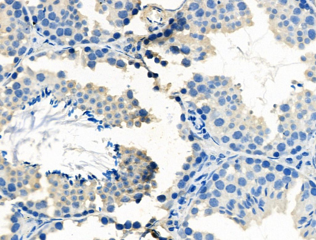 FSHR Antibody in Immunohistochemistry (Paraffin) (IHC (P))