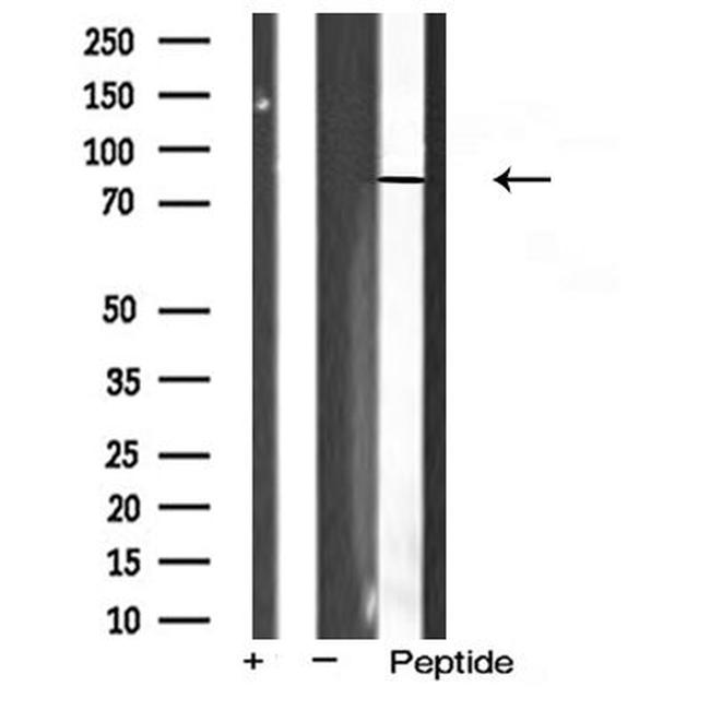 FSHR Antibody in Western Blot (WB)