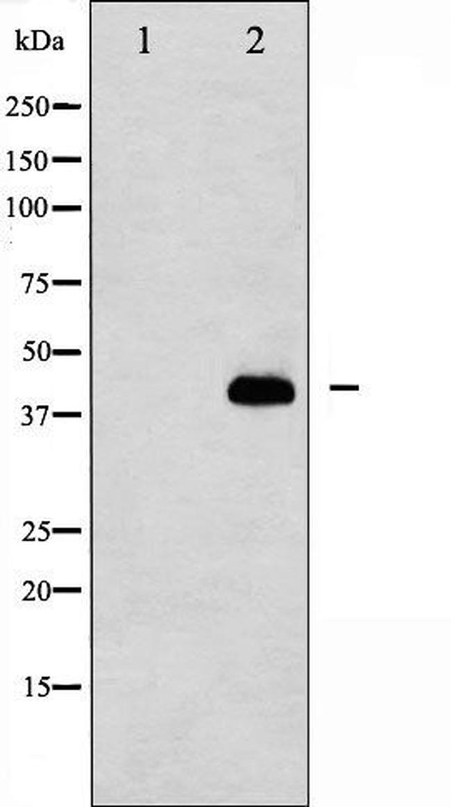 Caspase 8 (Cleaved Asp384) Antibody in Western Blot (WB)
