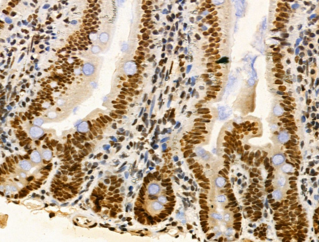 PIASy Antibody in Immunohistochemistry (Paraffin) (IHC (P))