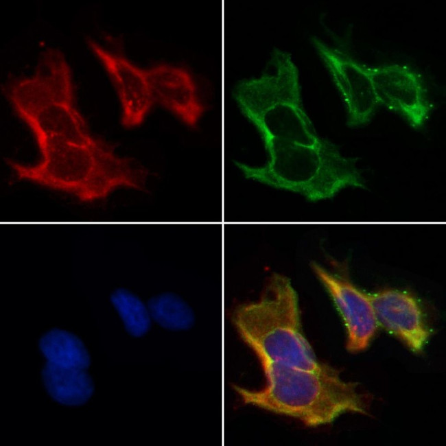 Cytokeratin 15 Antibody in Immunocytochemistry (ICC/IF)