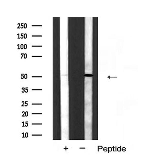 Cytokeratin 15 Antibody in Western Blot (WB)