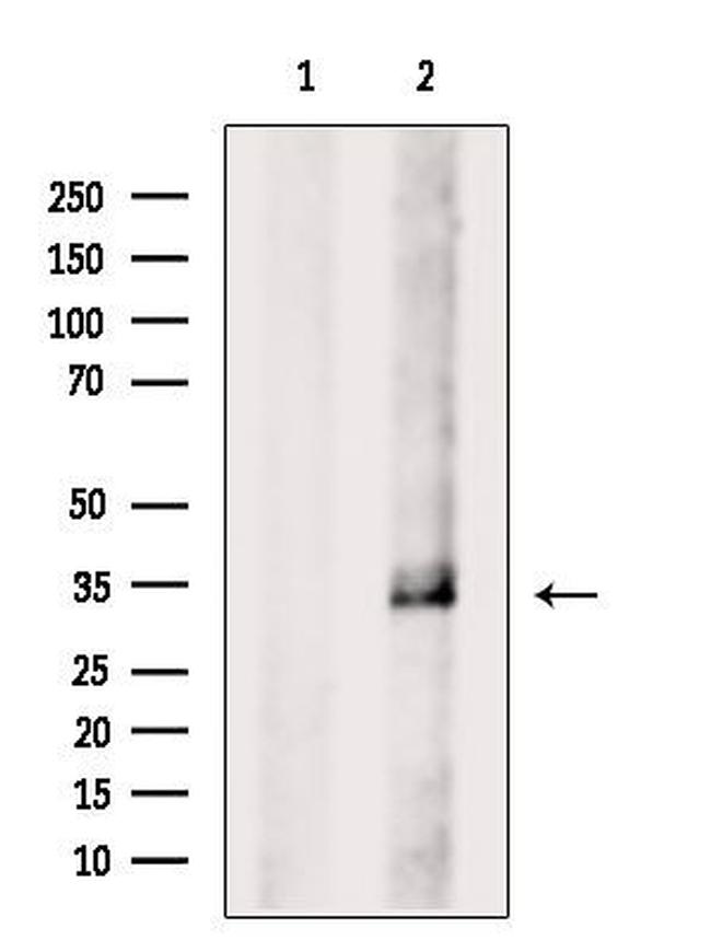 CDK5 Antibody in Western Blot (WB)