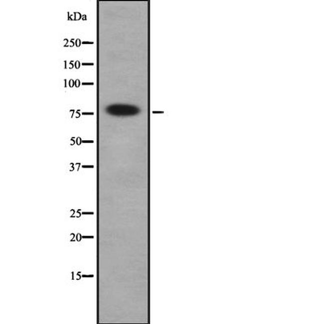 DNAI1 Antibody in Western Blot (WB)