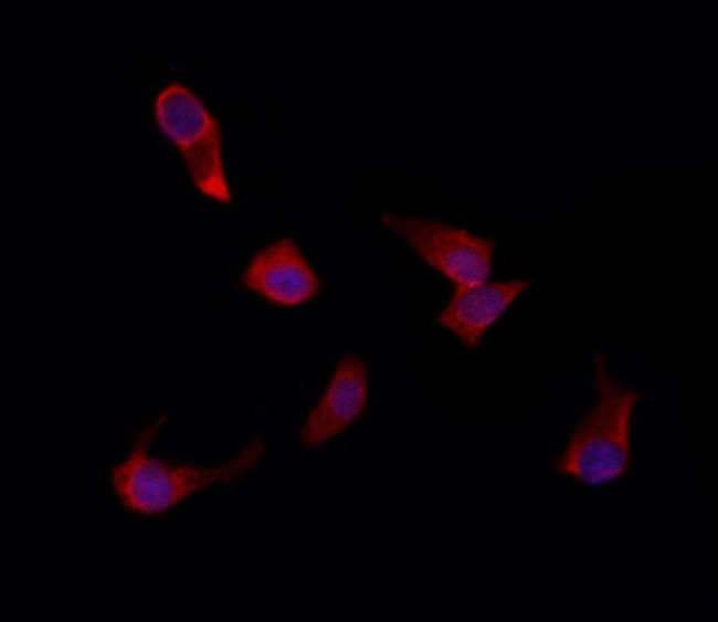 EPS8L3 Antibody in Immunocytochemistry (ICC/IF)