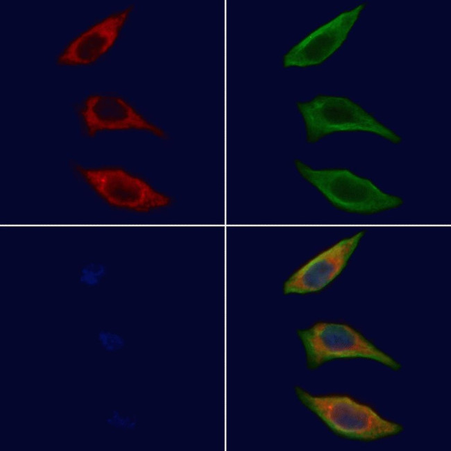 GRAP Antibody in Immunocytochemistry (ICC/IF)