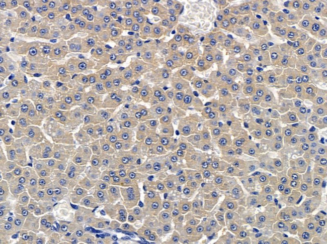 HABP2 Antibody in Immunohistochemistry (Paraffin) (IHC (P))