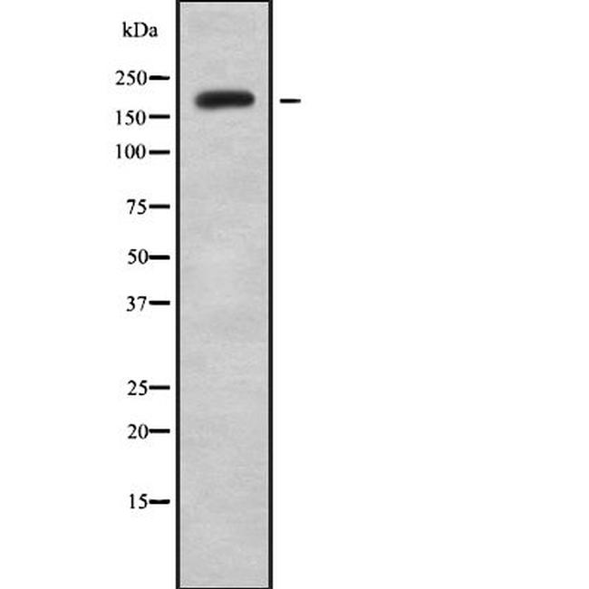 KIF13B Antibody in Western Blot (WB)