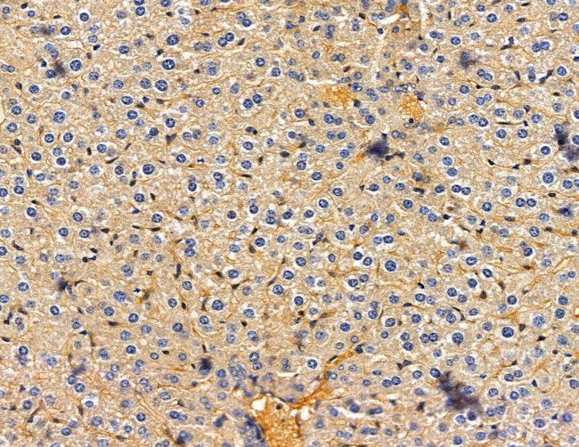 RAB3IP Antibody in Immunohistochemistry (Paraffin) (IHC (P))