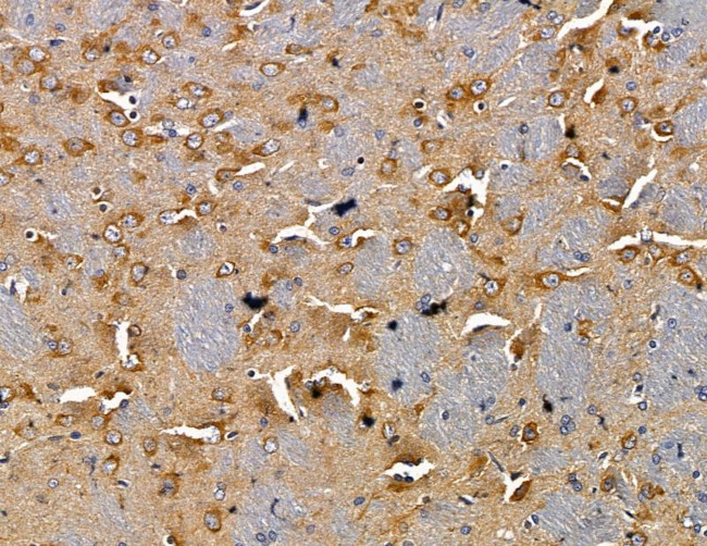 RAB3IP Antibody in Immunohistochemistry (Paraffin) (IHC (P))