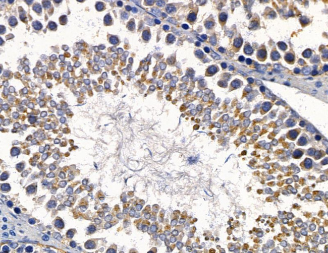 RAB3IP Antibody in Immunohistochemistry (Paraffin) (IHC (P))