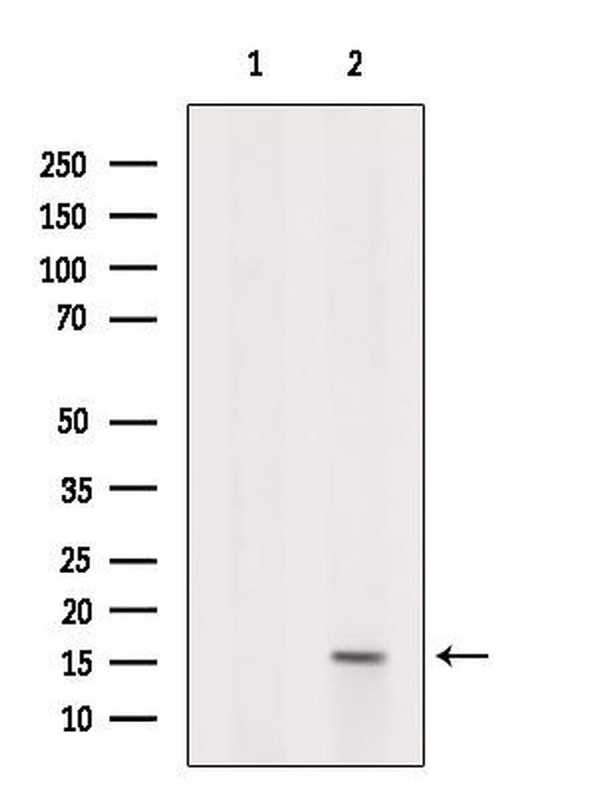 KIAA0087 Antibody in Western Blot (WB)