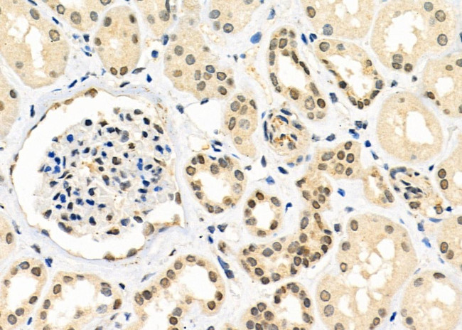 ZNF600 Antibody in Immunohistochemistry (Paraffin) (IHC (P))