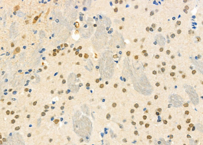 ZNF600 Antibody in Immunohistochemistry (Paraffin) (IHC (P))