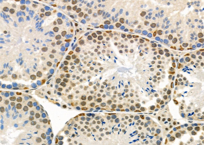 ZNF600 Antibody in Immunohistochemistry (Paraffin) (IHC (P))