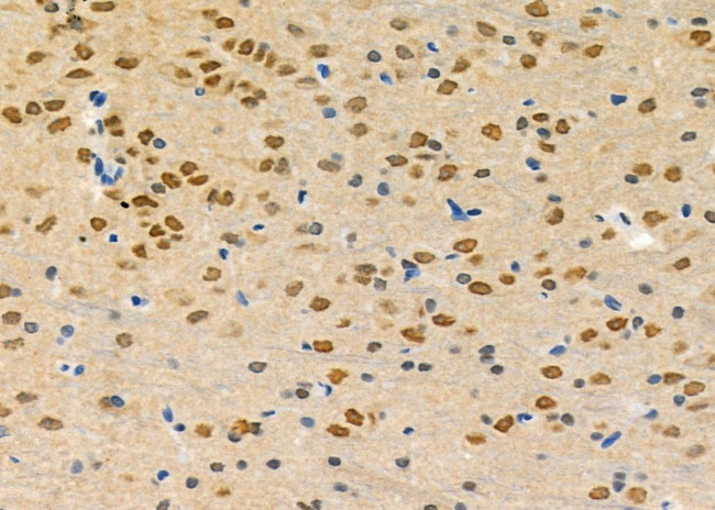 ZNF600 Antibody in Immunohistochemistry (Paraffin) (IHC (P))