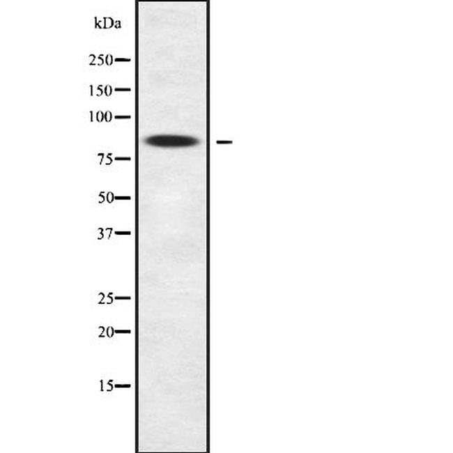 ZNF600 Antibody in Western Blot (WB)