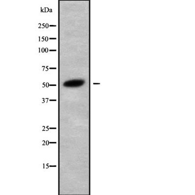 TRIM68 Antibody in Western Blot (WB)