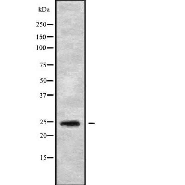 Sclerostin Antibody in Western Blot (WB)