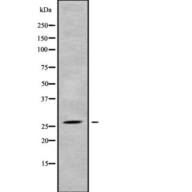 PLUNC Antibody in Western Blot (WB)