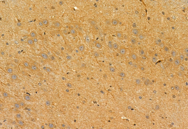 PYCR1 Antibody in Immunohistochemistry (Paraffin) (IHC (P))