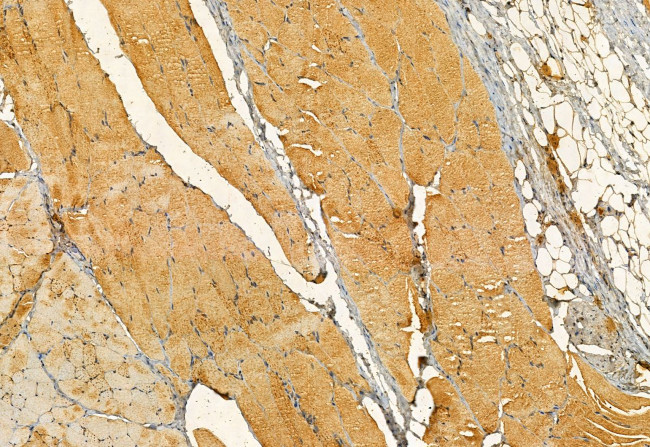 PYCR1 Antibody in Immunohistochemistry (Paraffin) (IHC (P))