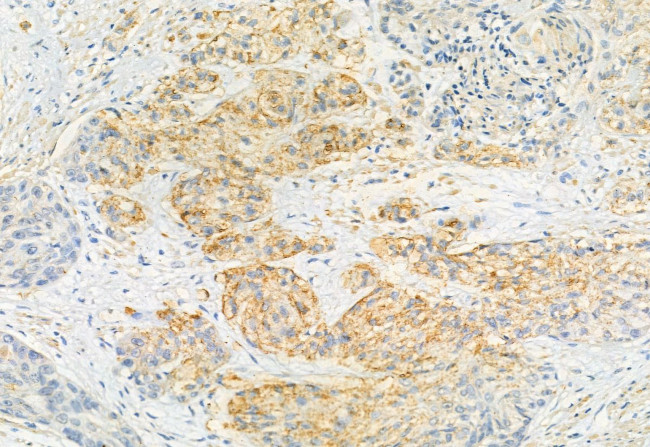 RAB27B Antibody in Immunohistochemistry (Paraffin) (IHC (P))