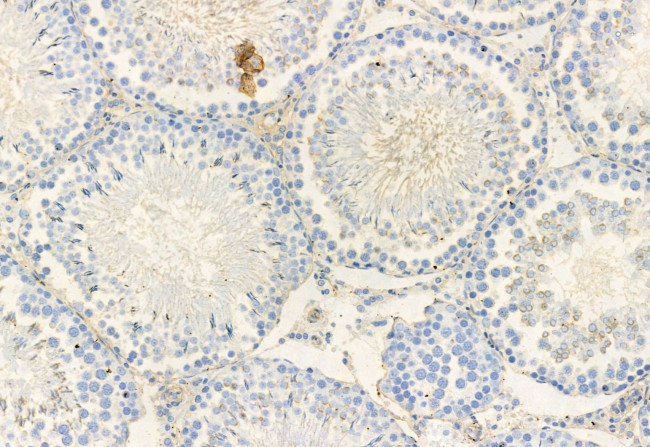 RAB27B Antibody in Immunohistochemistry (Paraffin) (IHC (P))