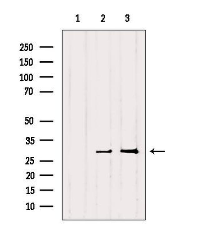 RAB27B Antibody in Western Blot (WB)