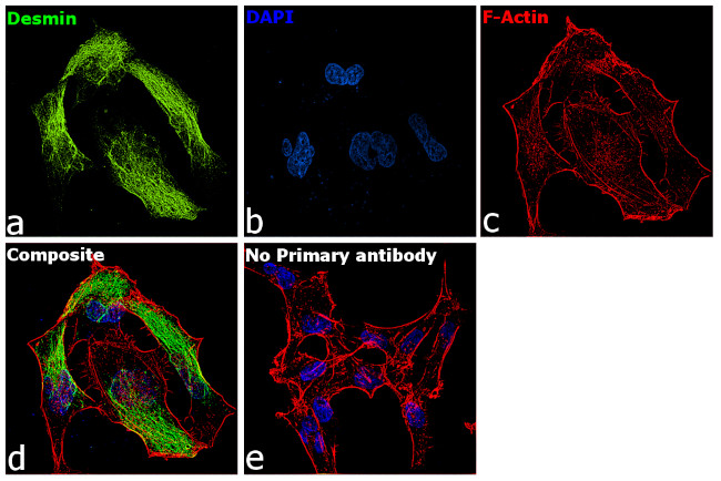 Desmin Antibody in Immunocytochemistry (ICC/IF)