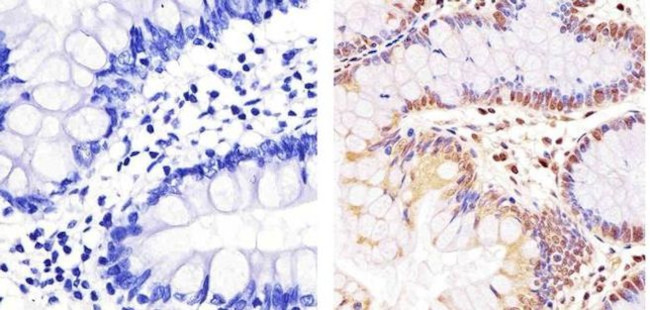 NFkB p65 Antibody in Immunohistochemistry (Paraffin) (IHC (P))