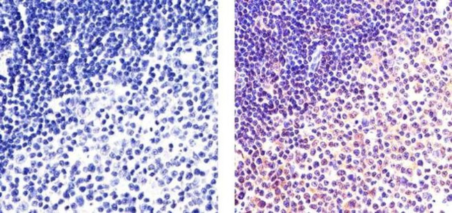 NFkB p65 Antibody in Immunohistochemistry (Paraffin) (IHC (P))