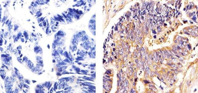 beta Tubulin Antibody in Immunohistochemistry (Paraffin) (IHC (P))