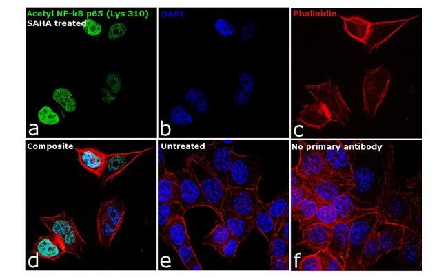 Acetyl-NFkB P65 (Lys310) Polyclonal Antibody (PA5-17264)