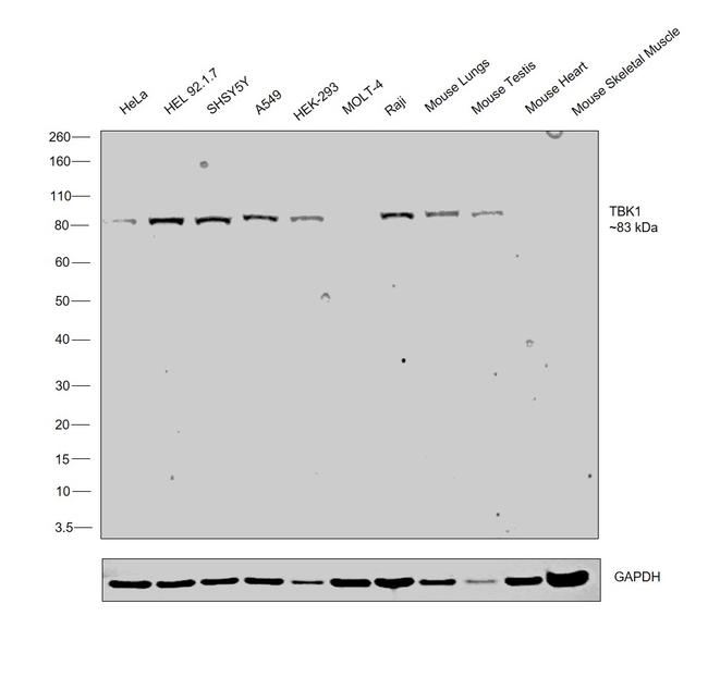 TBK1 Antibody in Western Blot (WB)