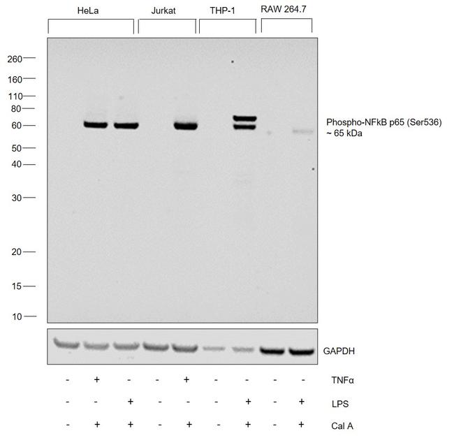 Phospho-NFkB P65 (Ser536) Polyclonal Antibody (PA5-17782)