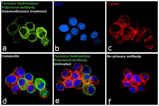 Tyrosine Hydroxylase Antibody in Immunocytochemistry (ICC/IF)