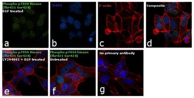 Phospho-p70 S6 Kinase (Thr421, Ser424) Antibody