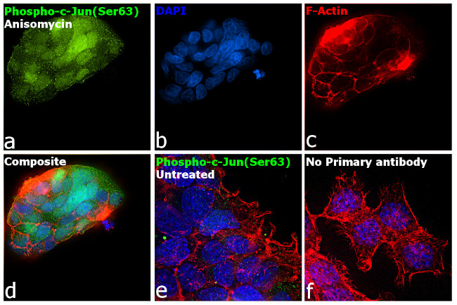 Phospho-c-Jun (Ser63) Antibody in Immunocytochemistry (ICC/IF)