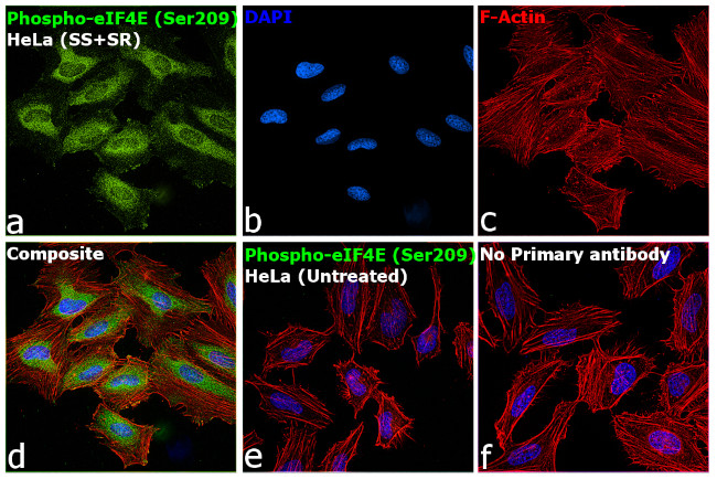 Phospho-eIF4E (Ser209) Antibody in Immunocytochemistry (ICC/IF)