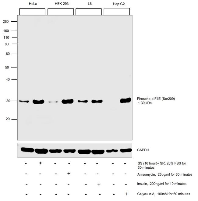 Phospho-eIF4E (Ser209) Antibody in Western Blot (WB)