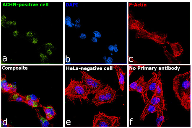 TIM-1 Antibody in Immunocytochemistry (ICC/IF)