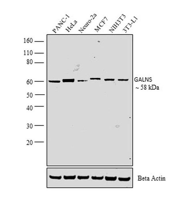GALNS Antibody in Western Blot (WB)