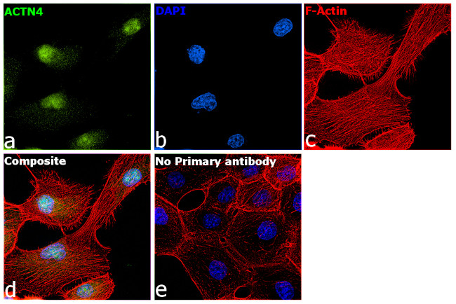 alpha Actinin 4 Antibody in Immunocytochemistry (ICC/IF)