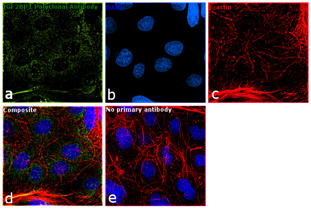 IGF2BP1 Antibody in Immunocytochemistry (ICC/IF)