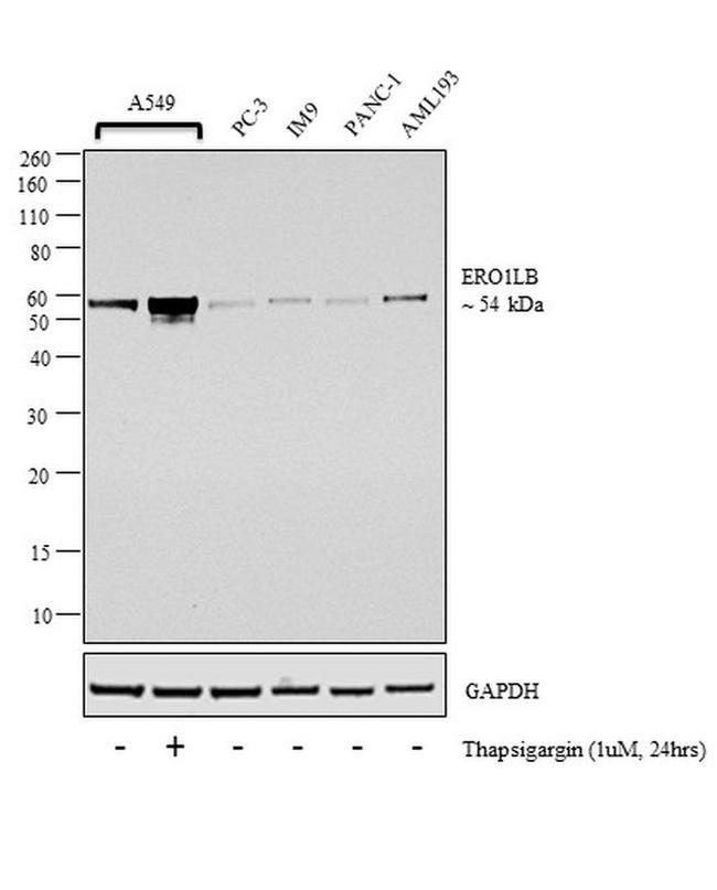 ERO1LB Antibody in Western Blot (WB)
